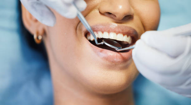 Best Knocked-Out Tooth Emergency  in Wauwatosa, WI