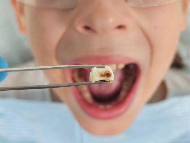 Best Urgent Tooth Repair  in Wauwatosa, WI